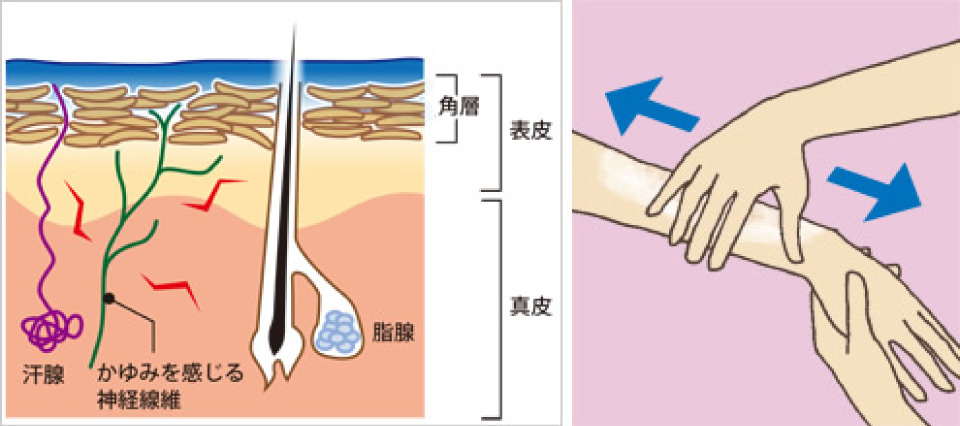 軟膏を塗り皮膚表面を保護する